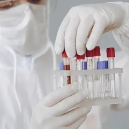 Редкие анализы для диагностики здоровья