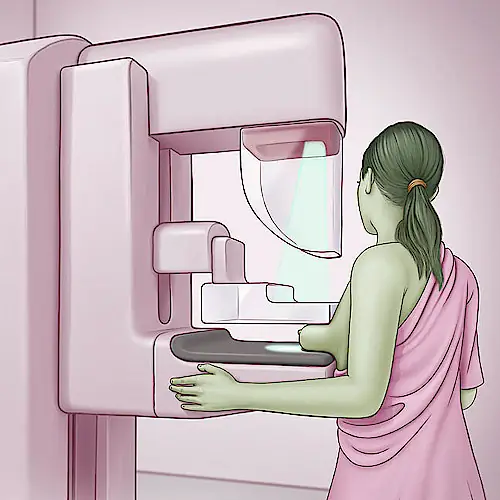 Выполнение маммографии